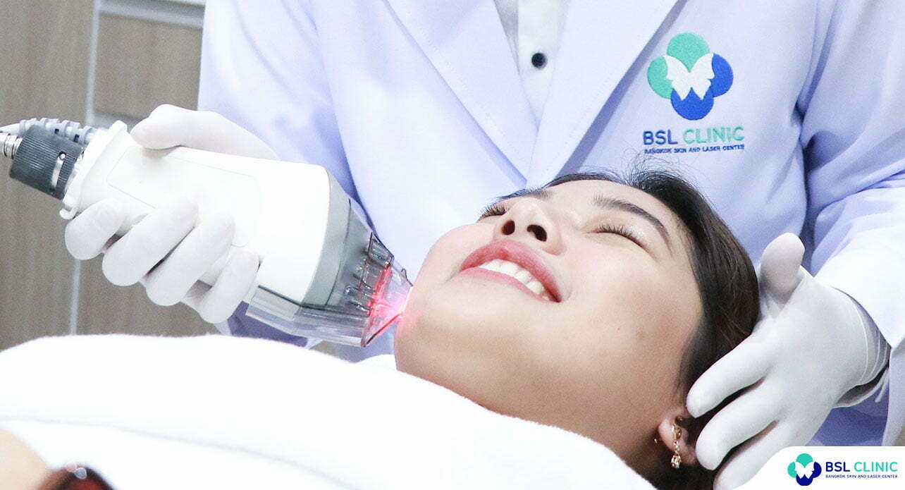 ทำไม "เลเซอร์รักษาสิว" ถึงช่วยกระตุ้นคอลลาเจนใต้ผิวหนังได้