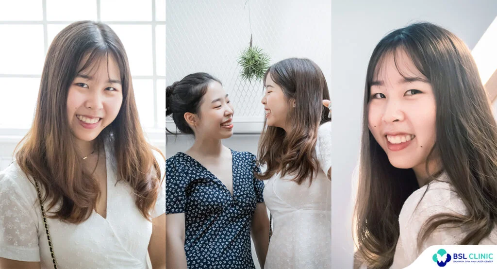 คนไข้รักษาสิว-ผิวแพ้ง่าย-เซ็บเดิร์ม