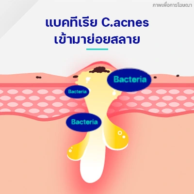 แบคทีเรียเข้ามาย่อยสลาย