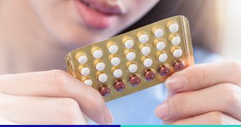 4 เหตุผลที่ควรรู้ก่อนใช้ยาคุมรักษาสิว