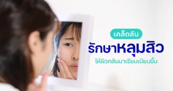 รักษาหลุมสิว ให้ผิวเรียบเนียน