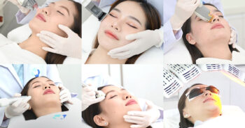 โปรแกรมรักษาสิว