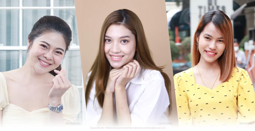 รีวิว-รักษาสิว-VDO-Review-acne